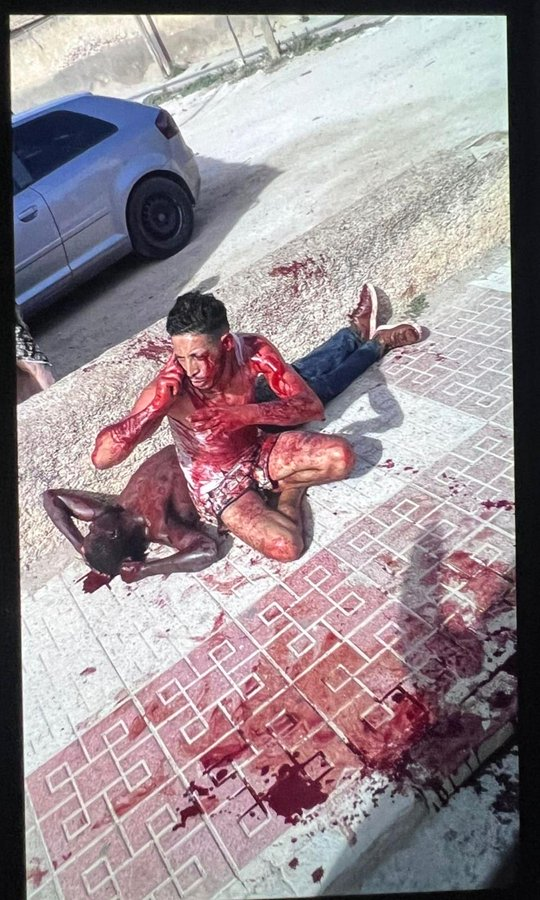 Anonymous_TA's tweet photo. Brote "Psicótico" en Torre Pacheco.

Pero el problema es de la ultraderecha https://t.co/chcAkr8mBp