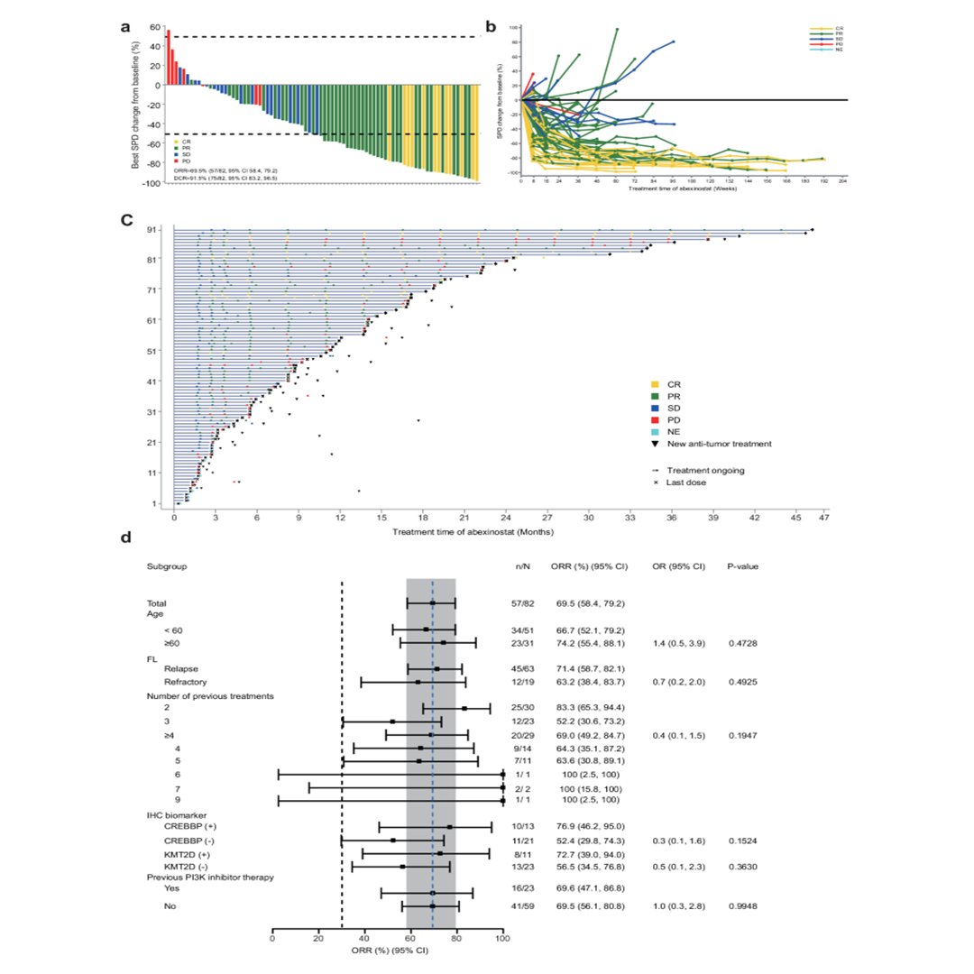 sigtrans_sttt's tweet photo. This phase 2 study evaluated abexinostat in relapsed or refractory follicular #lymphoma and reported durable clinical responses with manageable toxicity, highlighting it as a potential treatment strategy for patients with limited therapeutic options.

#STTT #OpenAccess: https://t.co/9TY56365pb

#Hematology #ClinicalTrials #CancerResearch  #TargetedTherapy