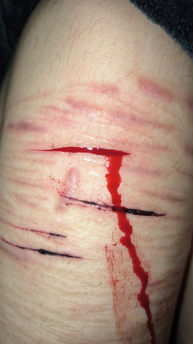 urnothorny's tweet photo. .
.
.
.
.
.
Here is an before and after of a multi swipe cut #bean #styro #multiswipe #shedtwt #shtwt #sh #slit #slittwt #babybean https://t.co/1giDIo8LpP