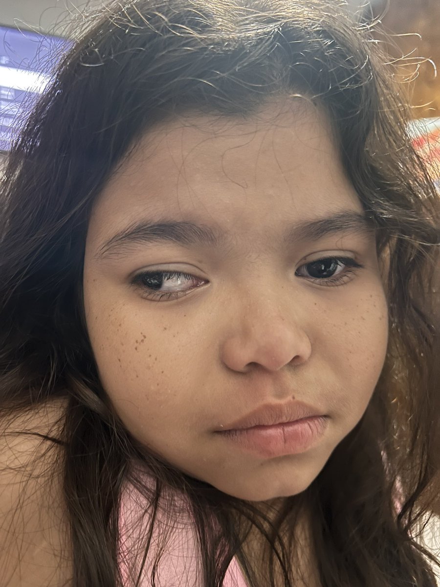 mariani87784922's tweet photo. Acá sigo sin dormir no tengo mi medicina trileptal susp para evitar convulsiones y no retroceder 😔soy una niña d condición con muchas ganas de vivir por favor ángeles son muchas mis necesidades médicas Dios les pague #venezuela #salud #urgente 
Pm
Mercantil
04246549764
17659326 https://t.co/xR0IwXaCss