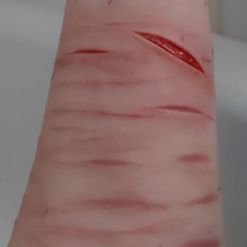 Kittehattakawa's tweet photo. Old cuts Σ(๑°꒳°๑)ᵎᵎᵎ
 (Ignore my fat arm)
#suicidetwt #988twt #Shedtwt https://t.co/3rosPJrvNN