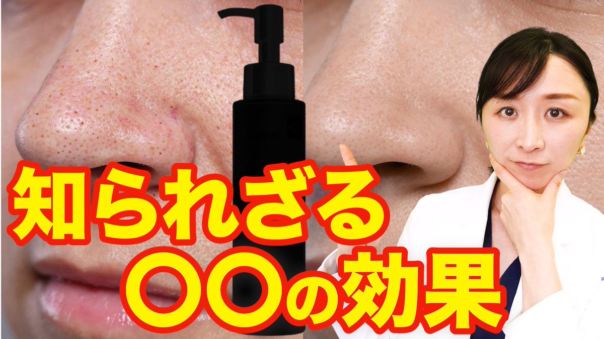 kobatomo_1's tweet photo. 【お知らせ】
着想から約2年…。

ありそうでなかった、新発想のアイテムが誕生しました！

毛穴や皮脂が気になる…
肌がゆらぎやすい…
ニキビができやすい…

当てはまる方はぜひご覧ください！

https://t.co/zuLCbgUVwL https://t.co/zL8RNBgM0F