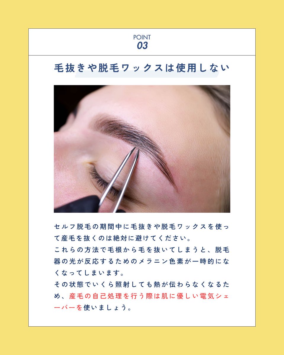 hygi_self's tweet photo. 🌿産毛脱毛でやりがちなNG行動🌿

❌毎日のように照射する
❌出力を無理に上げる
❌毛抜きやワックスで抜く

産毛は太い毛より効果が出るまで時間がかかる場合が多いです☑️

だからこそ焦りは禁物⚠️
正しいペースで続けることが、キレイへの近道です✨

#産毛脱毛 #セルフ脱毛サロンハイジ https://t.co/sM1orijUwO