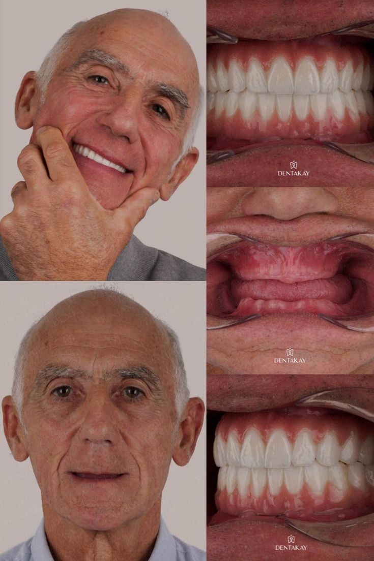 dentalstudiomw's tweet photo. KUKALAMBA NDIKUFUNA😆
 bwerani  tiire mano ena anyuwani
0885095592 https://t.co/LnpehkAcff