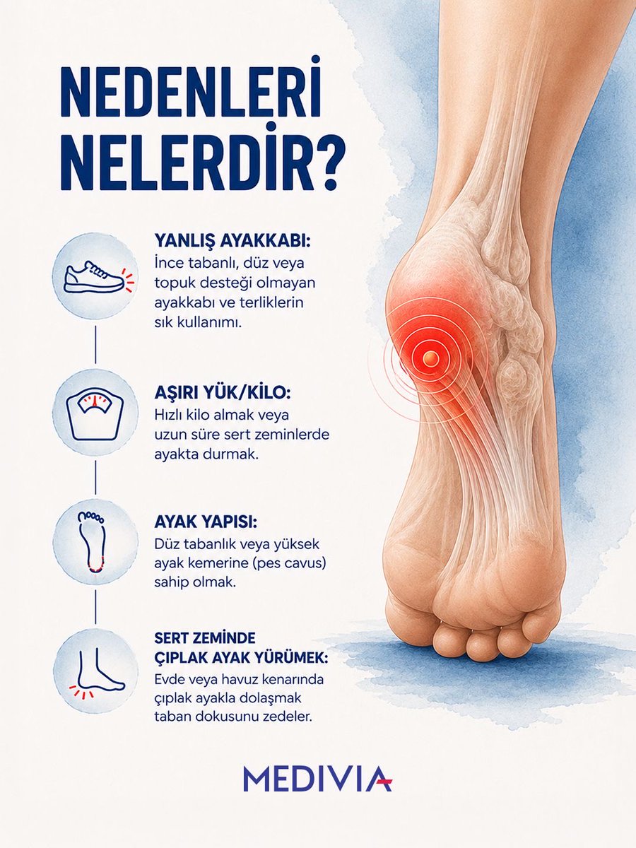 MediviaHospital's tweet photo. Topuk dikeni, topuk kemiği altında oluşan kemiksi çıkıntıdır ve genellikle ayak tabanını geren zarın (plantar fasya) iltihaplanmasıyla (plantar fasiit) ilişkilidir.

Belirtileri Nelerdir?
Sabah Ağrısı: Yataktan kalkıp atılan ilk adımlarda topukta veya ayak tabanında şiddetli batma hissi.
Gün Sonu Ağrısı: Uzun süre ayakta durulduktan veya yüründükten sonra topukta artan ağrı.
Hassasiyet: Topuk bölgesine veya ayak tabanına bastırıldığında duyulan ağrı.

Nedenleri Nelerdir?
Yanlış Ayakkabı: İnce tabanlı, düz veya topuk desteği olmayan ayakkabı ve terliklerin sık kullanımı.
Aşırı Yük/Kilo: Hızlı kilo almak veya uzun süre sert zeminlerde ayakta durmak.
Ayak Yapısı: Düz tabanlık veya yüksek ayak kemerine (pes cavus) sahip olmak.
Sert Zeminde Çıplak Ayak Yürümek: Evde veya havuz kenarında çıplak ayakla dolaşmak taban dokusunu zedeler.

Her cerrahi veya girişimsel işlemde sonuçlar kişiden kişiye değişiklik gösterebilir. İşlem öncesinde hekiminizden detaylı görüş almanız önerilir.