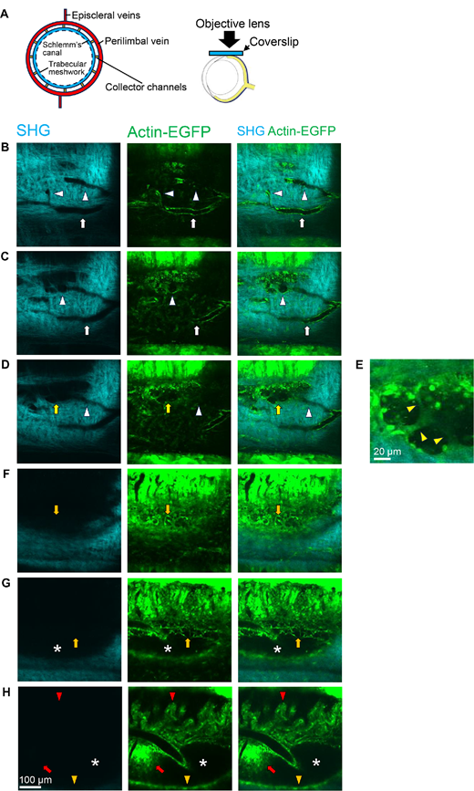 ARVOiovs's tweet photo. Yui Urahashi et al. from Kumamoto University develop an intravital imaging method that comprehensively shows the mouse conventional outflow pathway at high spatiotemporal resolution and investigate the fine structures and dynamics within this pathway.
https://t.co/Ma4S7vuIzO https://t.co/PDfclklI4B
