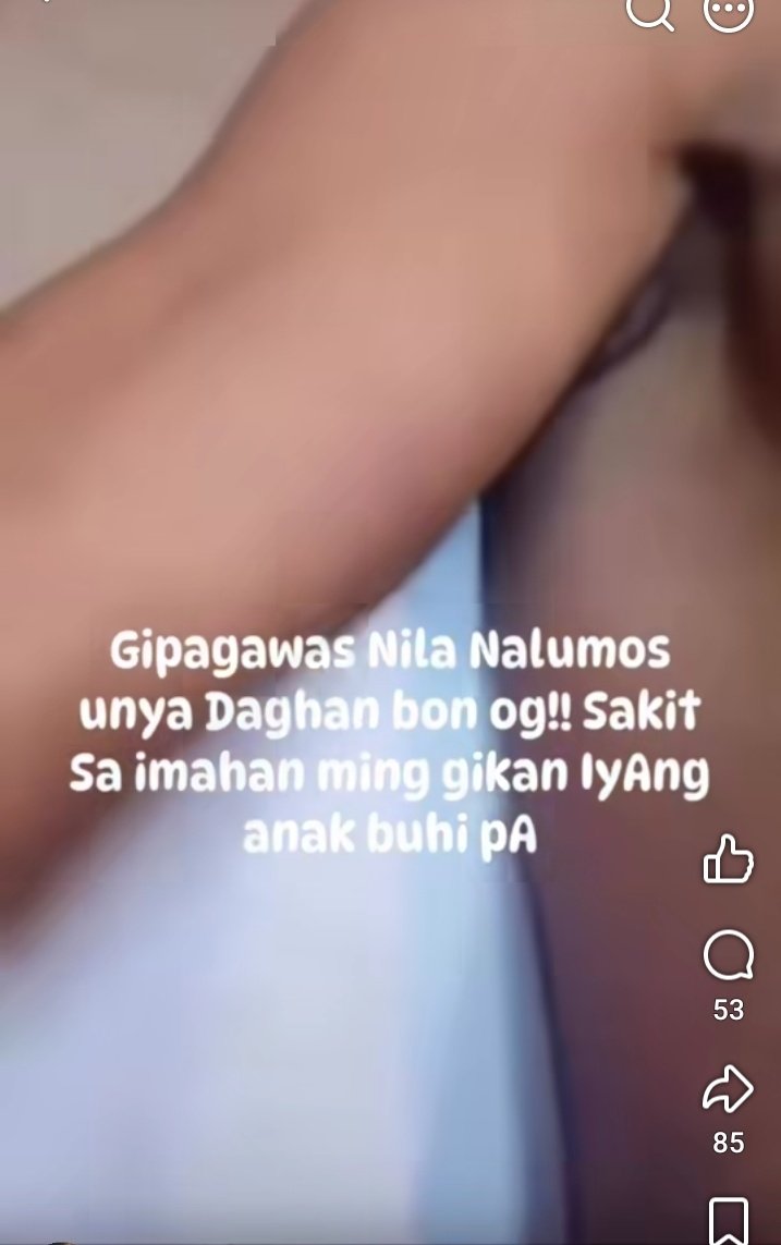 celistine27's tweet photo. Anung training ba ginawa nila na puro pasa pala talaga katawan ni rene😞lalo na tong mga  tagiliran nya laki ng pasa talaga.. pati sa likod ng legs nya meron Din.di Naman makuha to sa  alon  di na bago tong mga pasa nangitim  na.

#JusticeforBaterbonia https://t.co/QSxxTfDjld