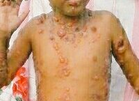 Alwathgeh8's tweet photo. تكفون يا اهل الخير  رتوويت
لعلها تصل لاهل الخير ارحموا حالة ابني
من يساعدنا بباقي تكلفة العلاج الله يجزاكم الخير
#السعوديه_الراس_الاخضر https://t.co/1mRMdabWdj