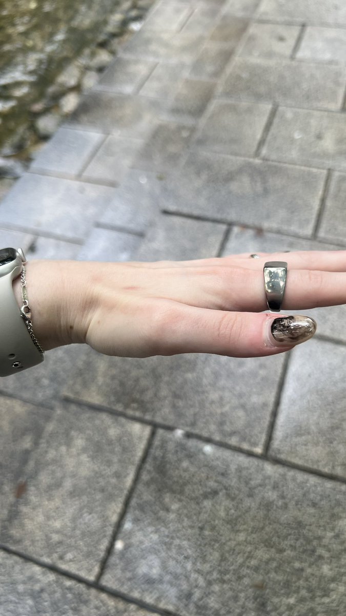 zerocaltsu's tweet photo. got bitten by a mosquito and my right hand is so swollen it hurts https://t.co/cKaHrnq3Kx