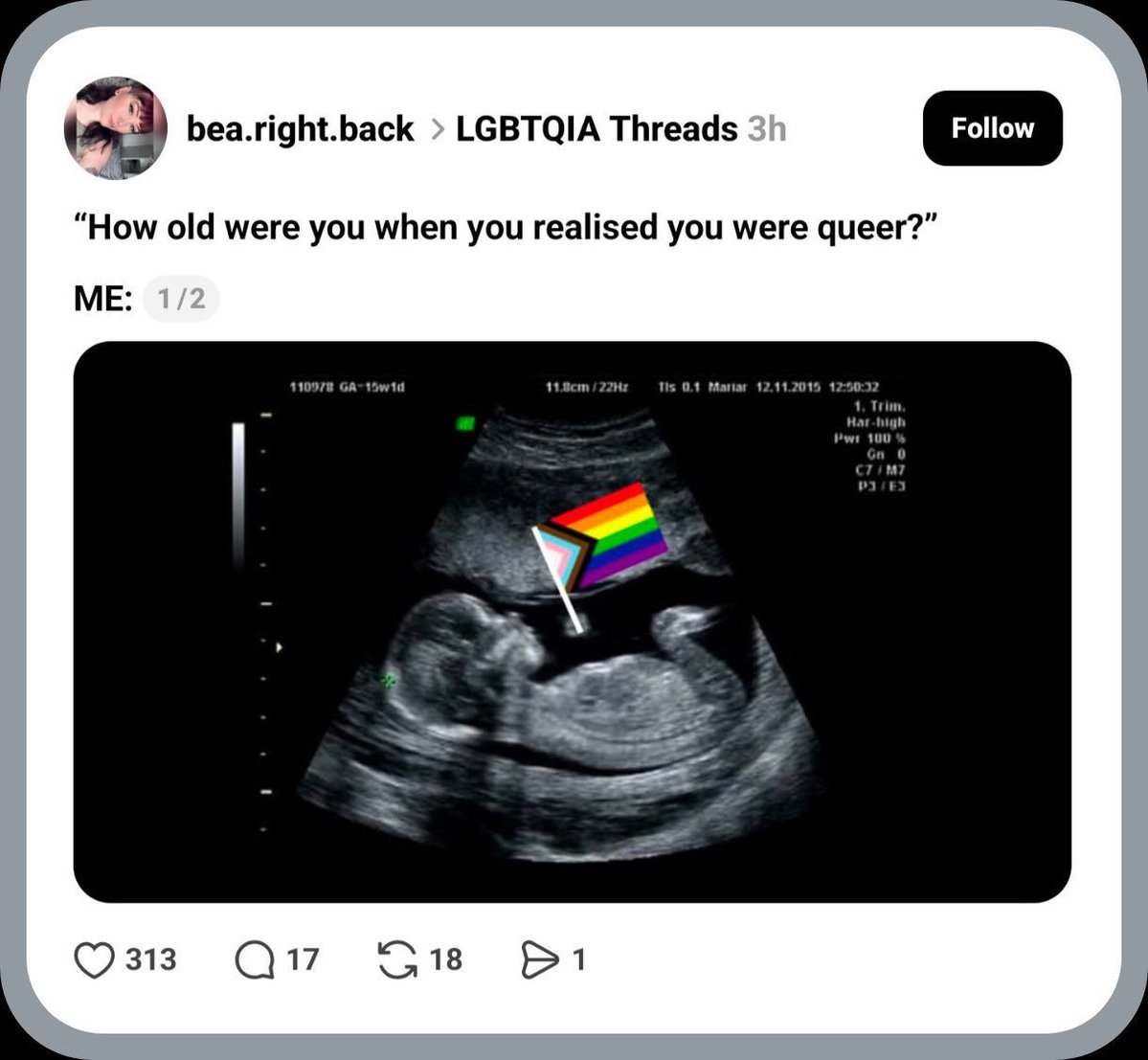wolverine7x's tweet photo. At least the pro-abortion people came up with a good argument for abortion. https://t.co/Zw2YFAnYBC
