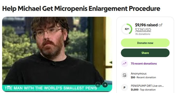 JohnyObrien's tweet photo. MAN WITH WORLDS SMALLEST DIH WANTS MONEY TO GET SURGERY VIA GOFUNDME

SENDING HIM 100% FEES VIA PUMPFUNDME GENNY NARRA

https://t.co/avjfiEeocF https://t.co/et3Y0Rt19B