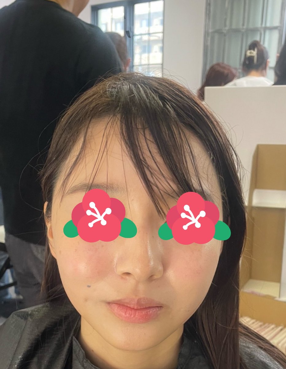 manarinnoheya's tweet photo. @Lunagrande__ 
#びゅーふるにて、ルナグランデさんに施術していただきました🥰
左:施術前←     →右:施術後
施術前に比べて頬がすっきりしたしフェイスラインが引き上がった！！！🥰
痩身って痛いイメージあるけどこれは注射ではなくじんわり温かい器具を当てる(続く
#びゅーふるレポ
#びゅーフェス https://t.co/kzOIO3DHBR