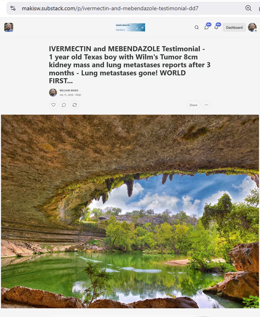MakisMedicine's tweet photo. BREAKING NEWS: IVERMECTIN and MEBENDAZOLE Testimonial - 1 year old Texas boy with Wilm's Tumor 8cm kidney mass and lung metastases reports after 3 months - Lung metastases gone! WORLD FIRST...

YOUNGEST IVERMECTIN CANCER SUCCESS case in the world!! 😃🙏

STORY:
1 year old Texas boy with Wilm’s Tumor 8cm kidney mass and lung metastases

In February 2026 he started:

Ivermectin 0.5mg/kg/day
Mebendazole 500mg/day
Chemo

Results after 3 months: Lung Metastases gone!!!

This has never been reported in a child this young, anywhere in the World!!! 😃

This is a WORLD FIRST....🙏

To the Big pharma con artists here on X, pretending to be Health Freedom fighters while trying to hurt cancer patients, especially these children with cancer, you can all burn in hell. 🔥😂

I will ALWAYS fight for children with cancer and I will call out all of you who are interfering with these Ivermectin Cancer success stories!!!

Evil will NEVER prevail.

God bless all children fighting cancer and their families!! ☦️