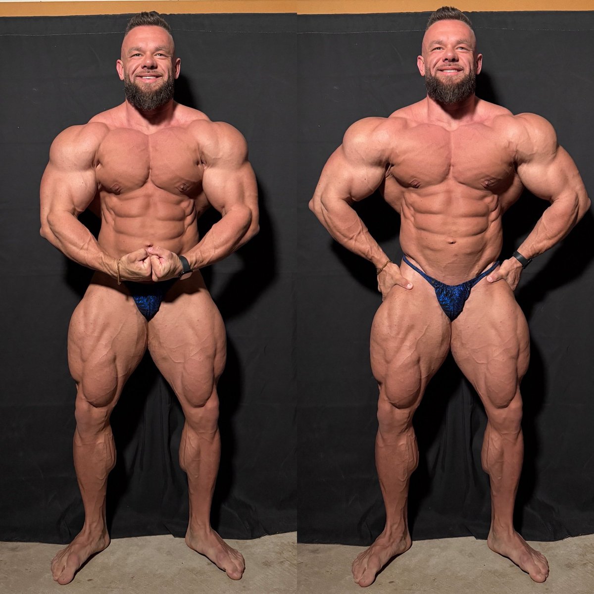 coachdavid167's tweet photo. You can buy expensive clothes, watches, and cars. But the one thing money can’t buy is a body that was earned through years of pain and discipline
#EarnedNotGiven #Fitness #GymMotivation
JOIN US ON TELEGRAM 👇👇👇👇👇
https://t.co/1abFTPF5TU https://t.co/q5Po6qbFXG
