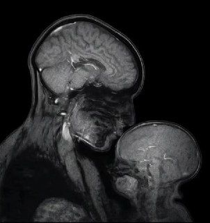 forallcurious's tweet photo. 🚨: Science confirms that a child "stays" in a mother's body and heart FOREVER! https://t.co/UKOMPleXc7