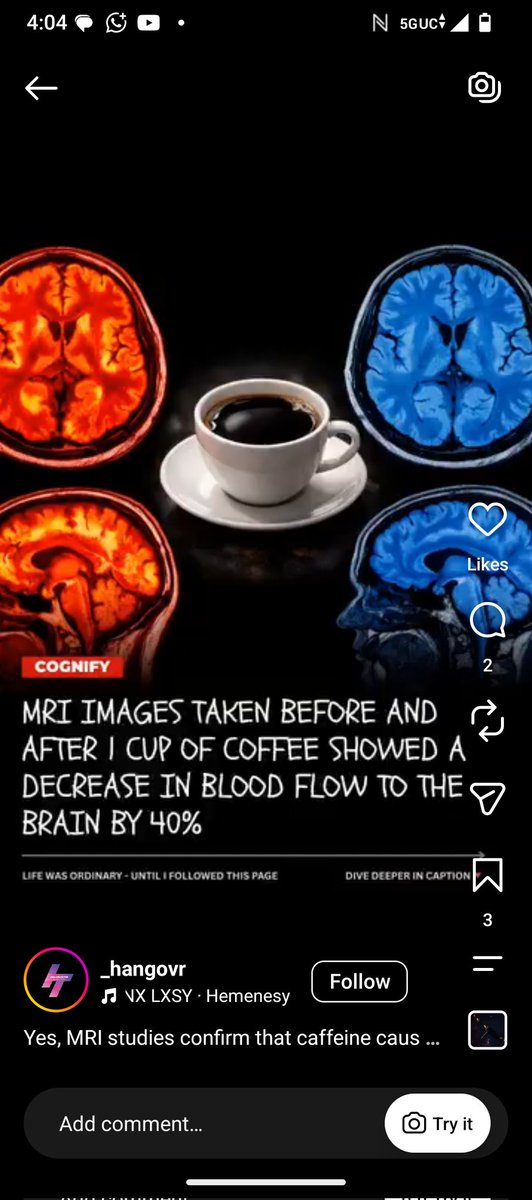 intelphere's tweet photo. @W19Dano @Tironianae For sure Harvard research results will be based on higher donators? Coffee's acidic &amp; reduces brain blood flow by 27–33% — proven. Brain needs iron &amp; oxygen, not acid. That "clarity" is just slower circulation. Check the real science. ☕🧠👇 https://t.co/LVXE0p484v https://t.co/pQPwPTiH3R