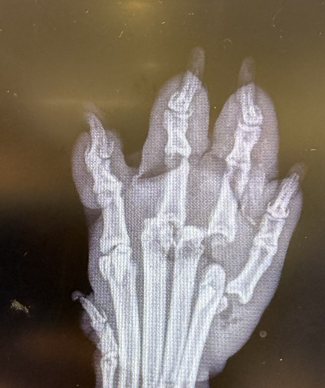 joey_tuccio's tweet photo. This is just one paw. Three fingers broken. He can't even walk because all his legs are broken. @nithyavraman is celebrating at a watch party tonight while this Skid Row dog suffers. Since Nithya never responded to helping these dogs, feel free to call the watch party location at (310) 295-0697 and ask if they can deliver a message to her. The message is "HELP SKID ROW DOGS". Please be nice to the event location. They are innocent. Nithya is not.