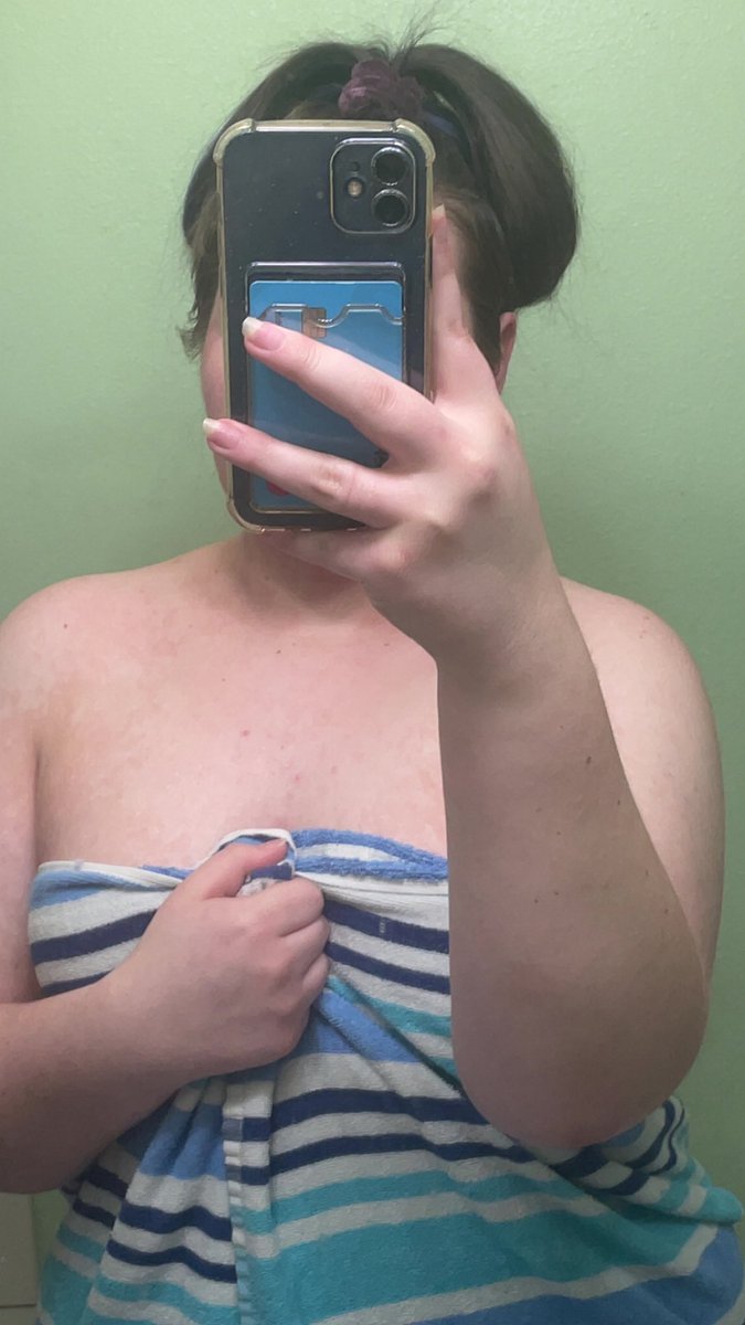 zoexbear261's tweet photo. Who wants to remove the towel?🤷‍♀️ https://t.co/4KrnzAmaEv