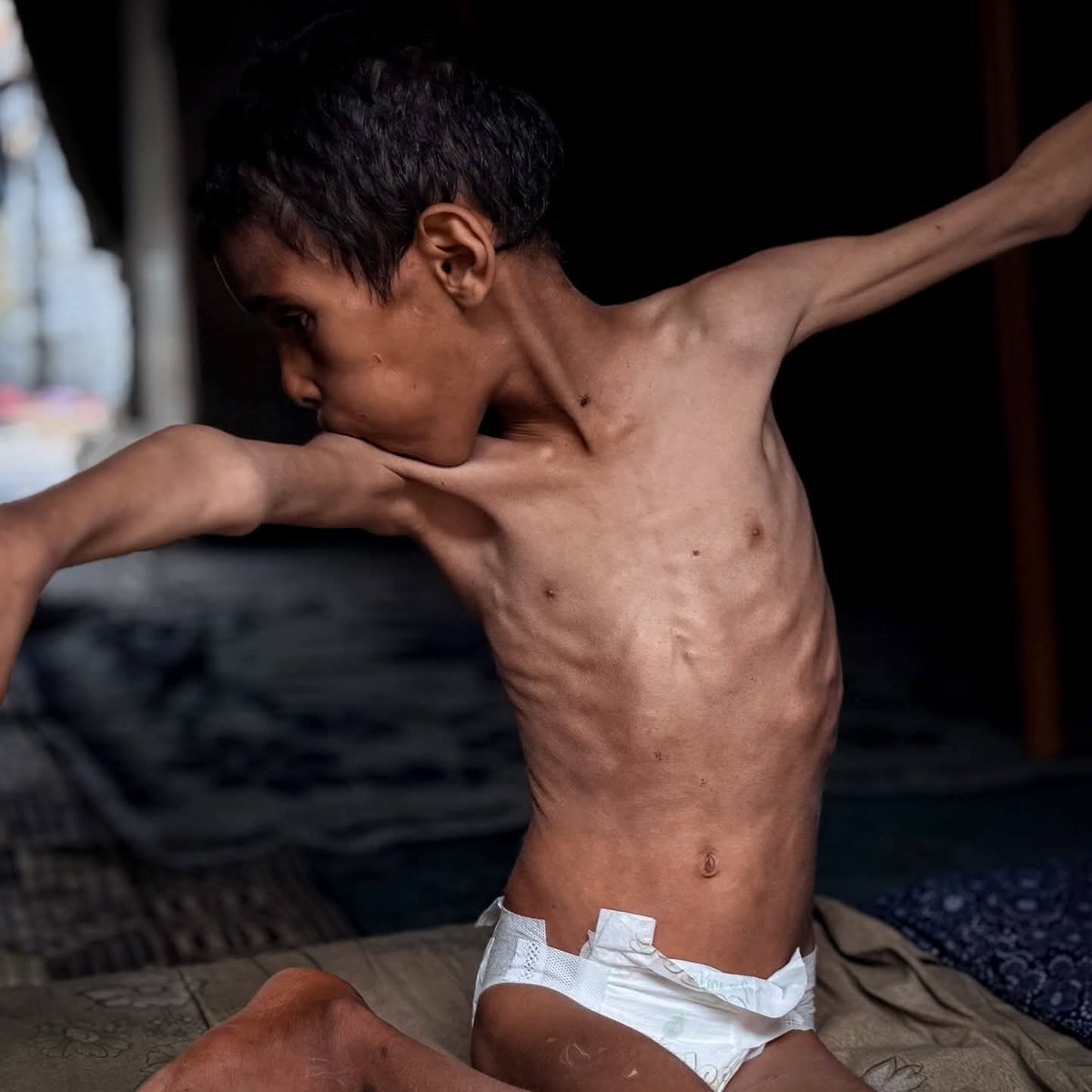 mhammedziad4's tweet photo. Hunger doesn’t wait… it slowly steals life, one moment at a time. 💔 https://t.co/CEFP8UtZih