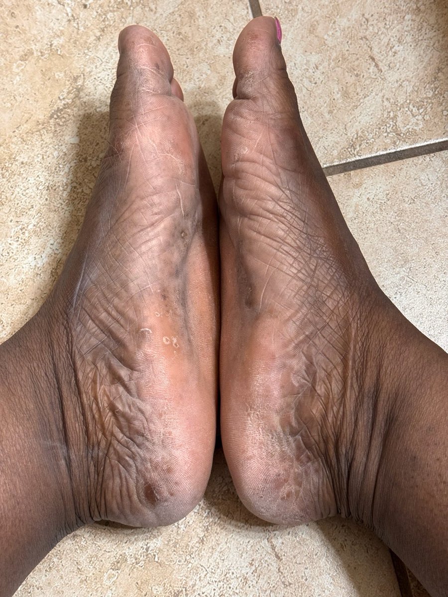 KQuingfeet's tweet photo. They got a lil dirty. Can you lick them clean for me pretty please 🥹 https://t.co/2zAIkCWQqT