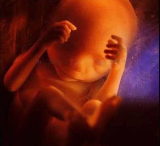 masvidaoficial's tweet photo. Te venden que el aborto pone fin a una persona en potencia, feto o conjunto de células. Lo que no te muestran es lo que vas a ver cuando las pastillas maten a tu hijo. Entonces será demasiado tarde, te arrepentirás toda la Vida, pero cumpliste su objetivo de que no te reproduzcas https://t.co/8N3M6EogKr