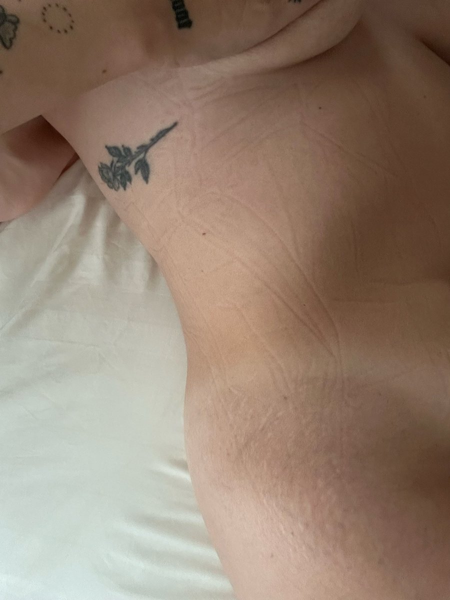 wtfxrachh's tweet photo. nap wrinkles😈 https://t.co/LM3x2QydCj