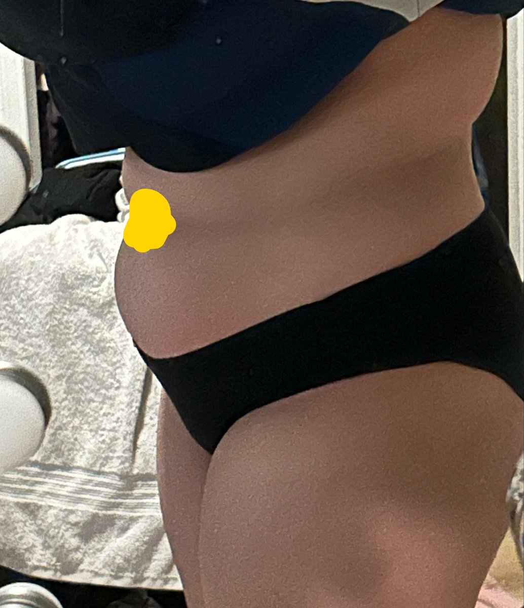 sadlilbunnss's tweet photo. Body not tea body milkshake… full of fat and calories. 😔 #edrtwt #edtwtㅤ #fatspo #obesespo  #firstbodycheck #bodycheck https://t.co/qNYkI9cyb7