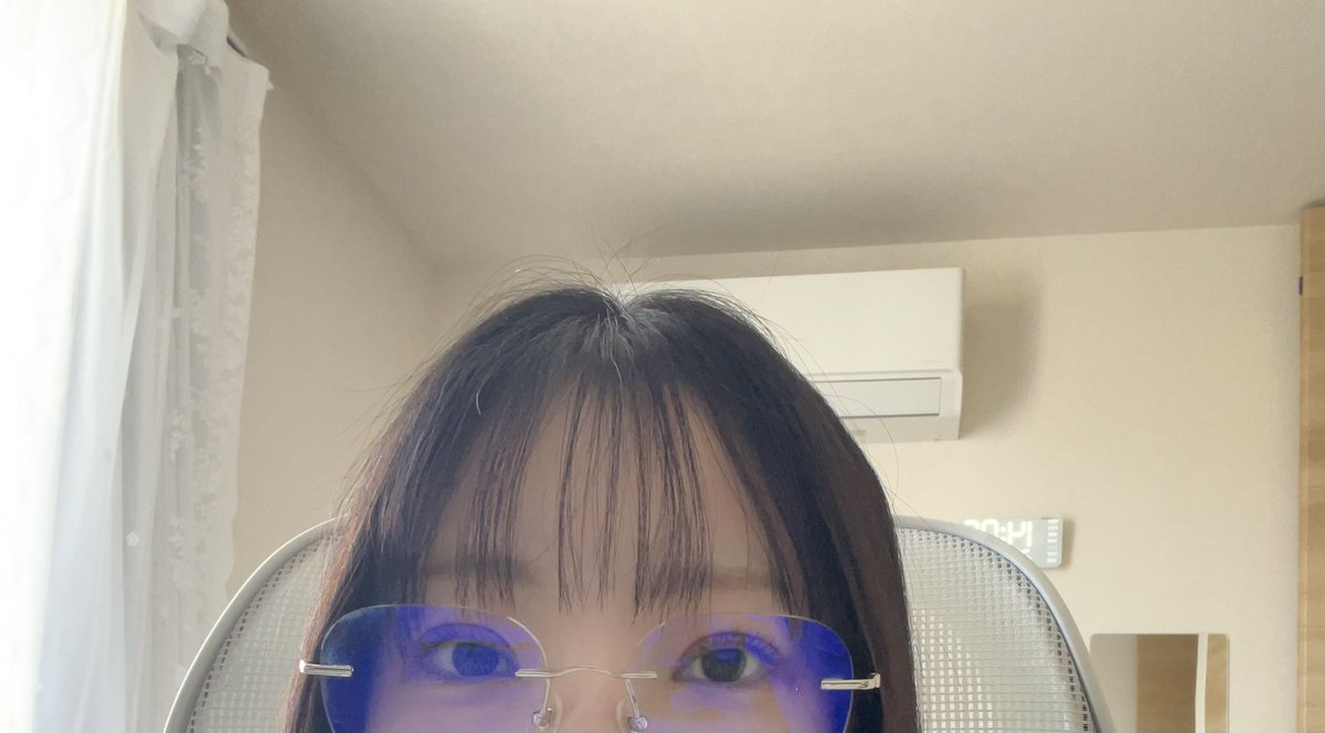 brain_niku's tweet photo. ダウンタイム中なのでメガネ
意外と腫れが引いてきているので、メガネならまぁ普通に外出れます。 https://t.co/nUiNybrqep