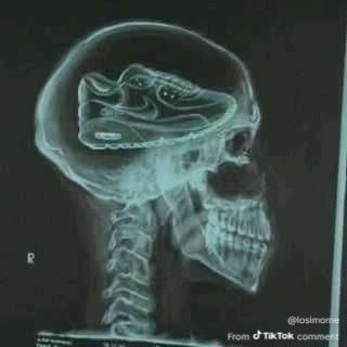 88Dicky88's tweet photo. @anzaroot1 تراها مجرد ملاهي يا ابو دقه https://t.co/y6UKj8lqlB