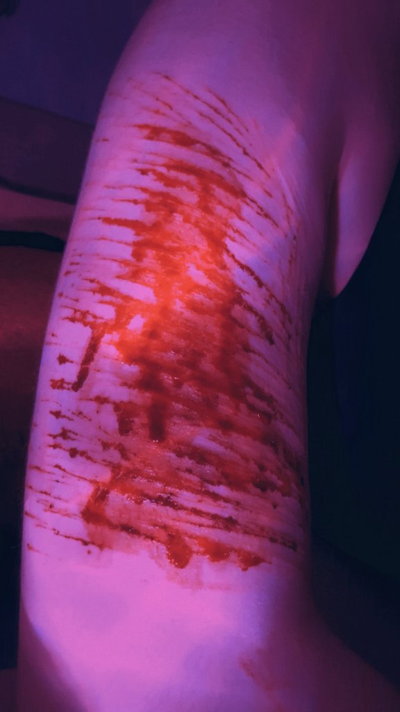 Anxious_Ardwolf's tweet photo. !FAKE!AIGENERATED!SFXMAKEUP!
#988twt #Slittwt #ShEdtwt #Suicidetwt 
Now vs 6-ish years ago (^з^)-☆ https://t.co/5bK4vr9pAL