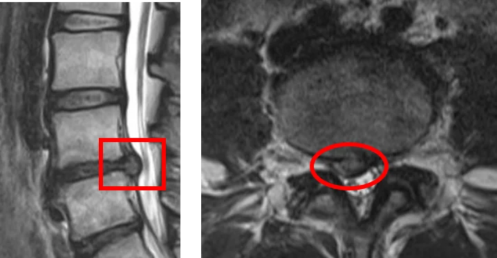 ILC_Osaka's tweet photo. 当院では、無料画像相談を行っております。
既に撮影されたMRI・レントゲン画像と問診票を当院まで送付していただくだけで、医師が遠隔にて診断して、患者様の腰痛に合った治療法を提案します。
#腰痛 でお悩みの場合は一度当院での診察を受けることをご検討ください。
#ILC国際腰痛クリニック大阪 https://t.co/39mDefsxZR