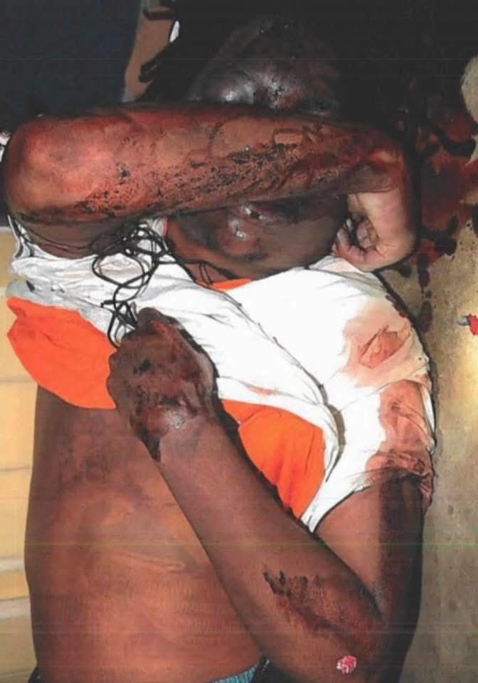bAnthonYsr's tweet photo. Did y’all know the case of Kendrick Johnson never got solved. 13 years ago, he fought a white classmate, and the father of the white boy was extremely mad because he lost the fight, and asked Kendrick to come over and fight him again. Kendrick refused. Soon after, Kendrick walked into the gym room of his school, and was attacked. They claim he fell into a gym mat and wasn’t able to free himself. And all the damage you see done in these pictures below, he done it to himself. The family wasn’t informed he was deceased till the next morning. And his body was took unauthorized, split open, organs took from his body, which is nowhere to be found till this day. They stuffed his body with newspaper like he was a garbage can, and closed him back up. The family had no idea until they had him checked again for their own investigation. They even went as far to cut his whole back open for no reason at all. He was tased, beat, choked and I’m sure manhandled by more than 2 people. #JusticeForKendrickJohnson #sayhisname