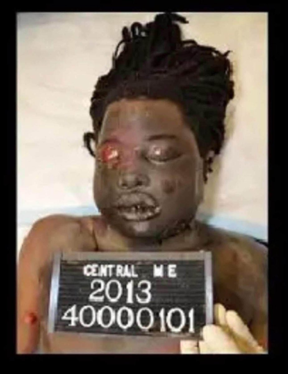 bAnthonYsr's tweet photo. Did y’all know the case of Kendrick Johnson never got solved. 13 years ago, he fought a white classmate, and the father of the white boy was extremely mad because he lost the fight, and asked Kendrick to come over and fight him again. Kendrick refused. Soon after, Kendrick walked into the gym room of his school, and was attacked. They claim he fell into a gym mat and wasn’t able to free himself. And all the damage you see done in these pictures below, he done it to himself. The family wasn’t informed he was deceased till the next morning. And his body was took unauthorized, split open, organs took from his body, which is nowhere to be found till this day. They stuffed his body with newspaper like he was a garbage can, and closed him back up. The family had no idea until they had him checked again for their own investigation. They even went as far to cut his whole back open for no reason at all. He was tased, beat, choked and I’m sure manhandled by more than 2 people. #JusticeForKendrickJohnson #sayhisname