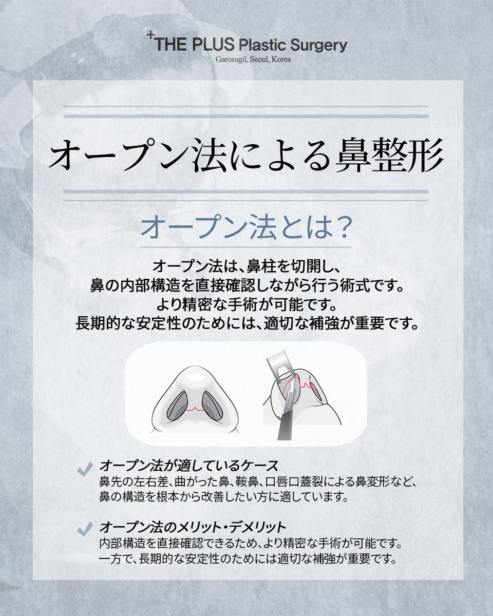 theplusjapan's tweet photo. 🔍オープン法による鼻整形🔍

オープン法は、鼻の内部構造を直接確認しながら行う術式です。
より精密な手術が可能で、鼻先の左右差や曲がった鼻など、複雑な症例にも対応できます。
お気軽にご相談ください✨

💌 LINE相談・ご予約
https://t.co/eIPd8KufGy

#韓国整形 #鼻整形 #オープン法 #鼻修正 https://t.co/SCP0DWqRWS