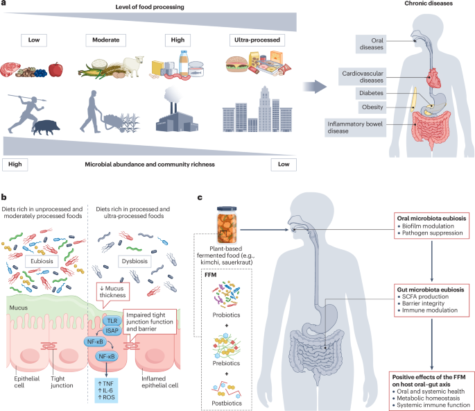 GMFHx's tweet photo. Emerging science helps to better understand the fermented food microbiome and how it impacts oral and gut microbiota

Learn more about what's new

@NatureRevMicro 

https://t.co/igWYQO94jm https://t.co/4s7Sl0RcZ3