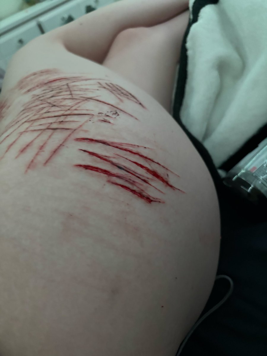 MathewMacdona16's tweet photo. Final damage of the night I guess? Idek i hurt all over but it never feels like enough #slittwt #shedtwt #fuckingfuck #fakemakeup #sfx https://t.co/XiB7IAi1So