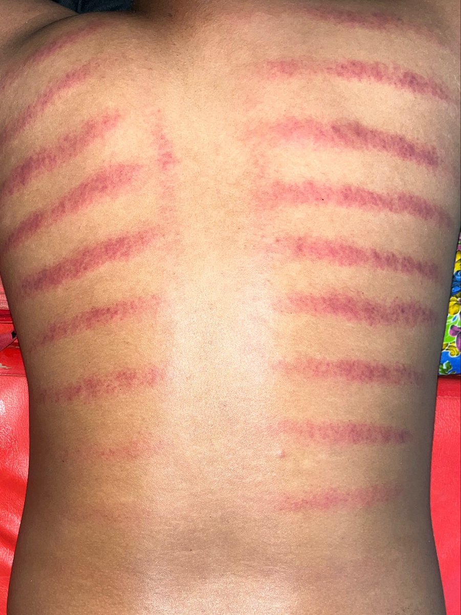 widyoza's tweet photo. day 24 kkn dah berubah jadi harimau https://t.co/NwsHr3STIy