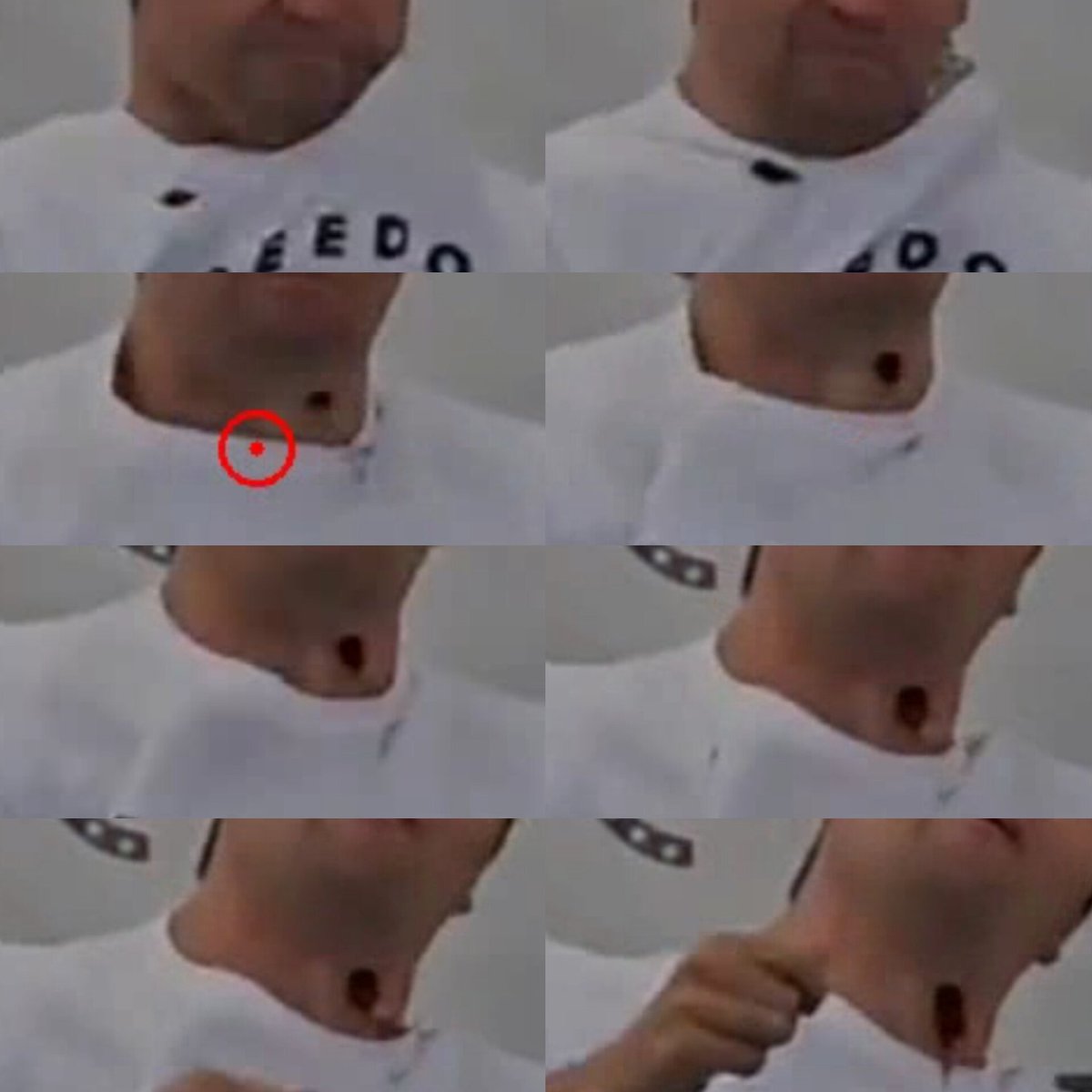 jonaaronbray's tweet photo. To believe that a .30 caliber bullet struck Charlie's neck, you must ignore the following:

- The wound exhibits no characteristics of a high-velocity impact.

- The circuit board caused his shirt collar to rise up over his cheek, becoming exposed before falling back underneath the shirt.

- The necklace snapped before any wound appeared and flew up and around his head.

- The battery impacted his neck, penetrating the tissue and causing a laceration of the jugular before falling out of the wound.

- Fragments of the RØDE microphone case flew out from underneath Charlie's shirt.

 - The low-frequency event originating from under the tent timed perfectly with the shirt movement.

- There is a complete absence of a temporary cavity, which a 150-grain bullet would produce upon impacting soft tissue.