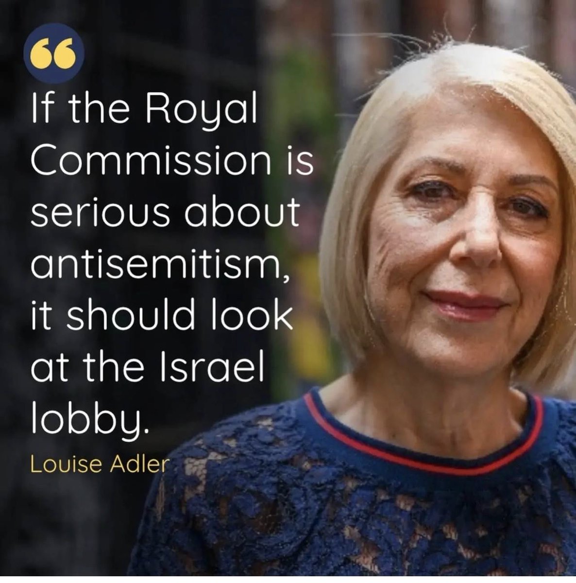 SeanCur35382542's tweet photo. Liberate Palestine 🇵🇸 
                      ~
Seventy one kilometres from Tel Aviv, in Gaza, Zionist - Nazis  continue bombing slaughtering, defenceless, displaced Palestinians‼️

“Israeli air strikes in Gaza kill eight, including two children
Medics report 12 injuries alongside eight deaths in Gaza as Israeli air strikes target civilians and displaced families.
Listen to this article 3mins O
By Al Jazeera Staff
8 Jul 2026 | Updated a day ago
https://t.co/cseYPeL47A
Decent people everywhere will never forgive or forget the continuing, sub human barberism of the Zionist variant of Nazism, as it continues to slaughter with impunity, those who did nothing to stop them‼️

Be assured, the Zionist Nazis  will be held accountable for horror, pain & suffering of this Holocaust.
There will be no place for them to hide, the ICC is waiting ‼️

Sean Curley LLB
10July26🌾☘️
