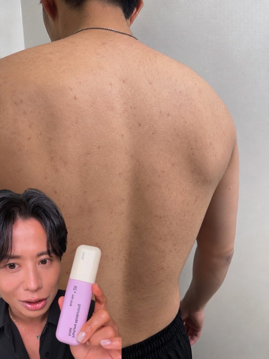 Adit99648675's tweet photo. 小田切信じてた。背中ビキニほぼ消えた。 https://t.co/84y2ff9XFh