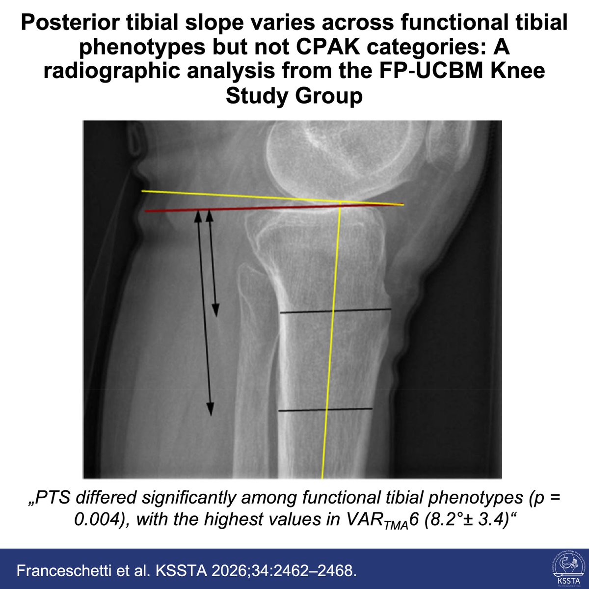 Knee Surgery, Sports Traumatology, Arthroscopy tweet media