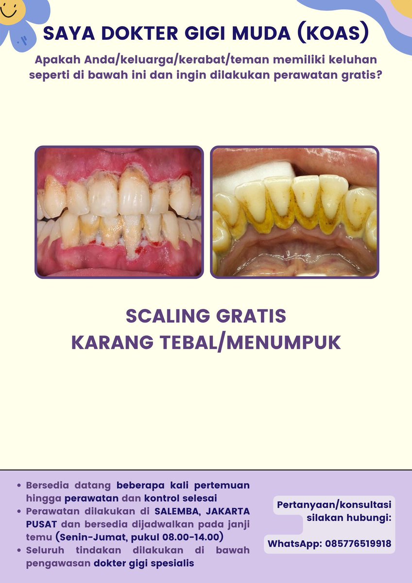 martellians's tweet photo. yang hari senin mau scaling bersihin karang gigi menumpuk gratis, dm dan fotokan giginya yaaa, tapi sekitar 3 kali pertemuan karena ada pertemuan kontrol #zonauang #scaling https://t.co/pcCWFbzonA