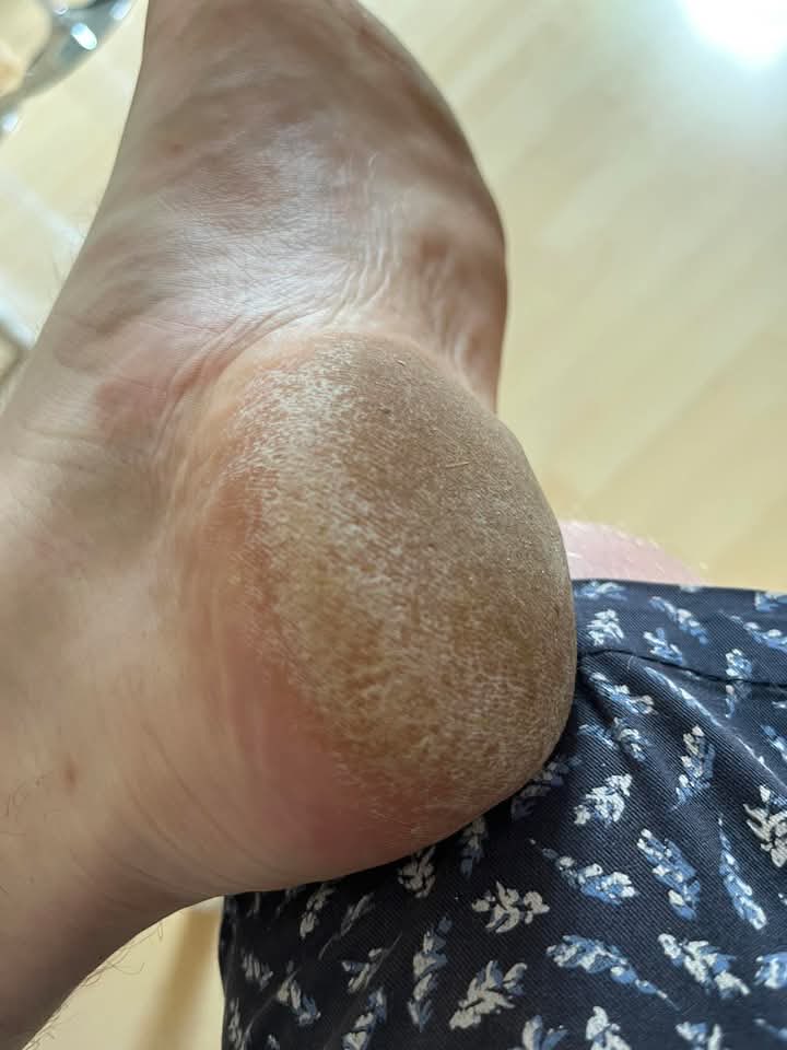 runnershighde's tweet photo. Morgens Barfuß spazieren gehen und danach die schwulete auspressen 👊🏻✊🏻🦶🏼 #findom #footfetish #masterfeet https://t.co/P1TizMPUzT
