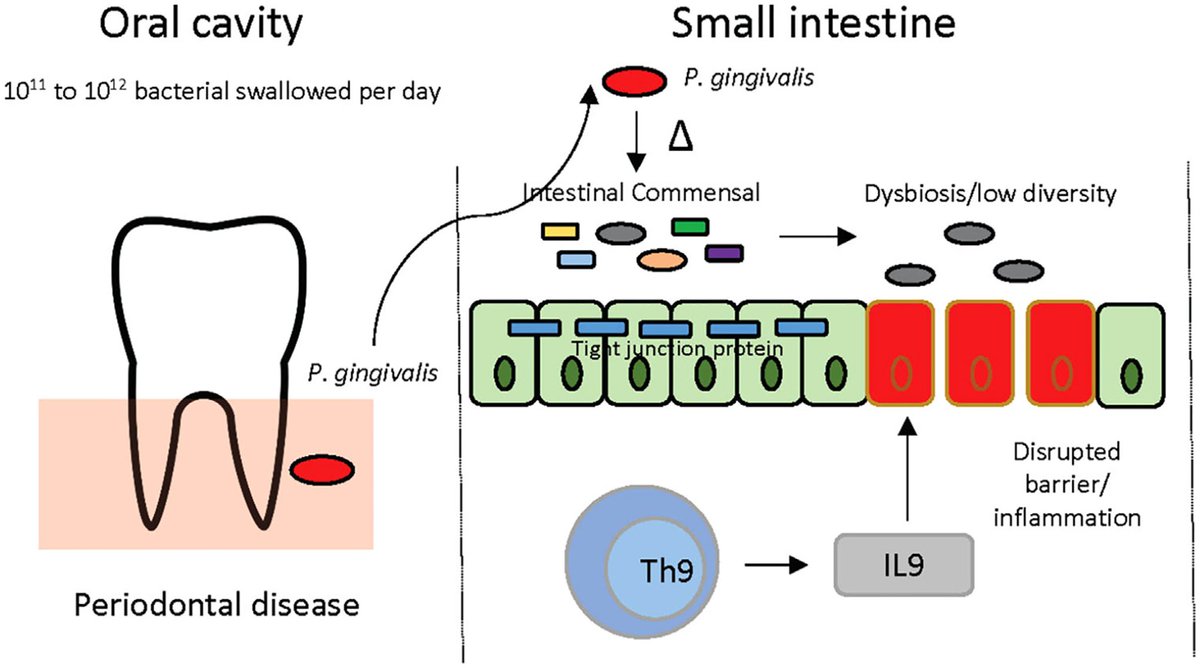DrGrahamLJ's tweet photo. How gum disease bacteria cause damage to the gut epithelial barrier (#LeakyGut)
Clue: you swallow them
👇
Porphyromonas gingivalis indirectly elicits intestinal inflammation by altering the gut microbiota ...
Sohn et al 2023
https://t.co/YJAWPkA8ws https://t.co/mZuvbZdRwQ