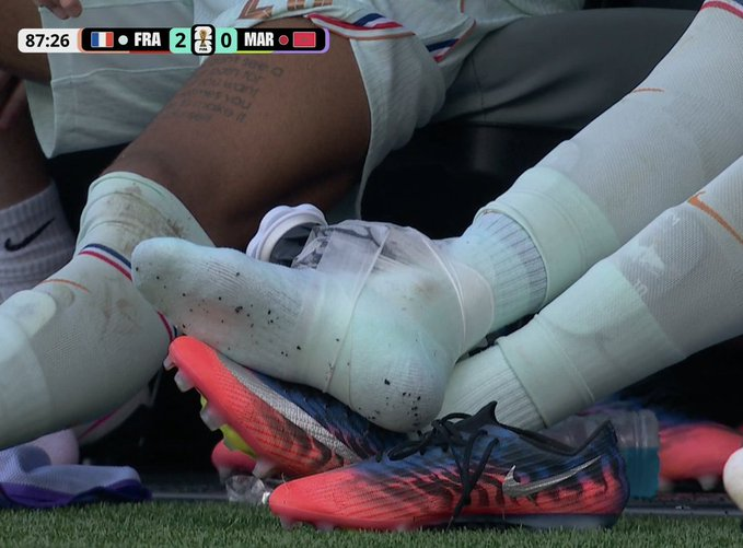 akram62295's tweet photo. KYLIAN MBAPPÉ'S ANKLE! https://t.co/33CgxRuNlI