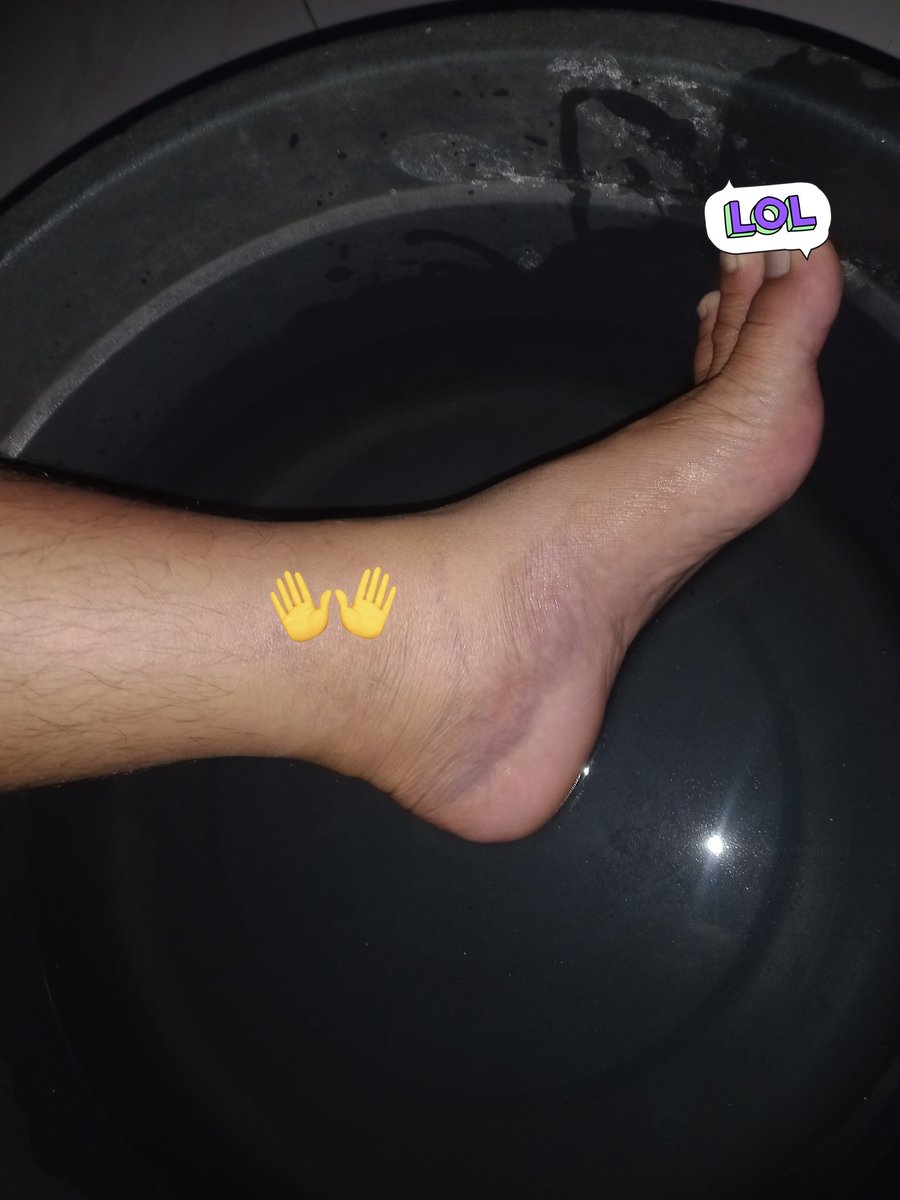 ssstyo4's tweet photo. katanya suruh kompres air hangat, tapi biar simple cemplungin aja 😅 https://t.co/Byt5PJwlXt