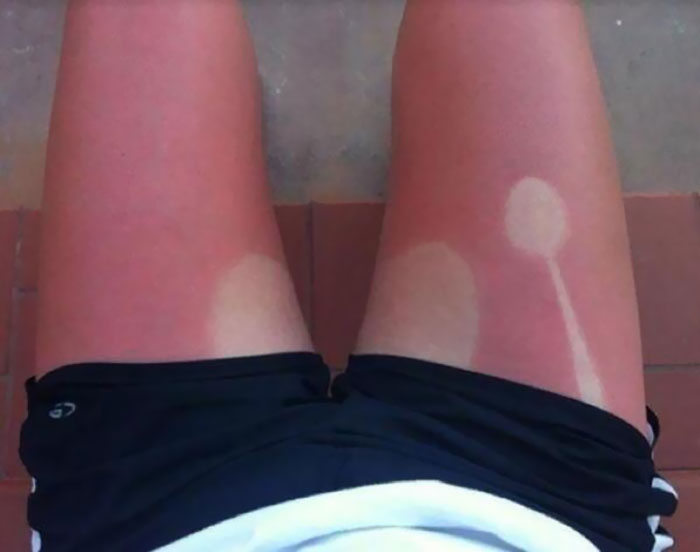 TheTuftandQuiff's tweet photo. Sat out, ostensibly in the shade, for an hour, wearing shorts and now I've got fucking sunburnt legs like an absolute fud. #Glasgow #TapsAff #Fud https://t.co/NUPU92ub4o