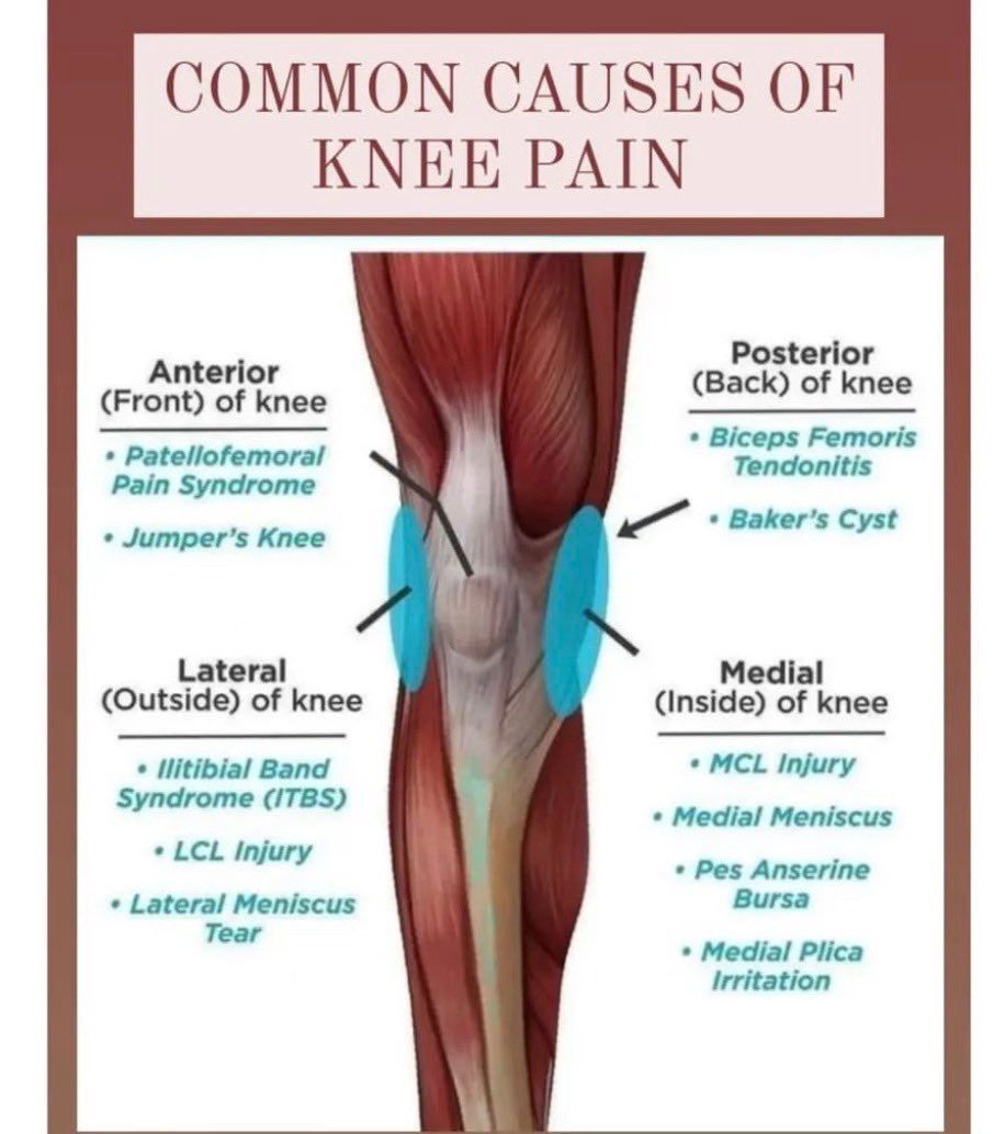MoAImam's tweet photo. Common causes of knee pain. https://t.co/QabK1EWknE