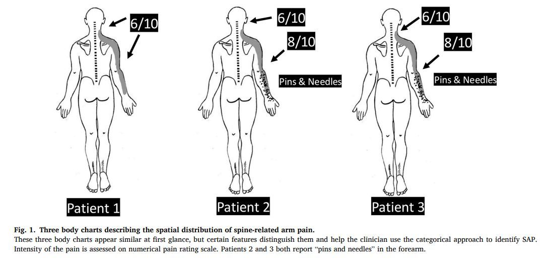 MSKPhysioJnl's tweet photo. 💡#Masterclass - 🟢 OPEN ACCESS - Are they all the same? - Check out our NEW masterclass on clinical tips in assessing Spine-related Arm Pain - https://t.co/wkA7Glmol1 #cervical #radicular #radiculopathy #referred https://t.co/mvuGxkOu0H