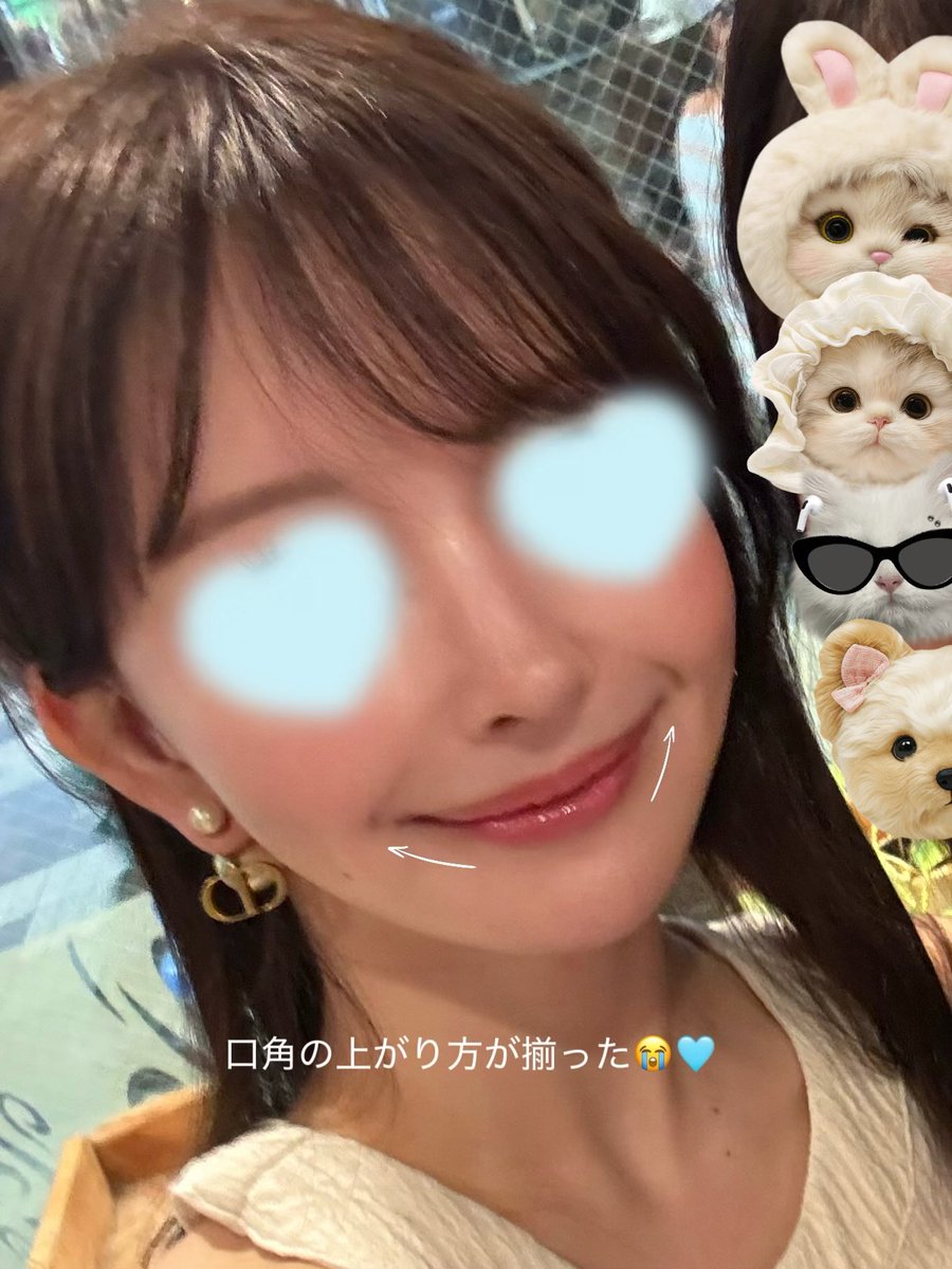 omochi57842411's tweet photo. ✅口元矯正ボト2週間経過レポ

ハルクリニックのボト後は、自分の笑顔がほんと好きになれる…😭🫶🏻

個人的に右頬の筋肉ボトがめちゃいい仕事してて、右の口角の上がり方をあえて抑えて、左口角の上がり方と合うように微調整してもらって‥

特に口元ボトは1単位の違いで変に歪んだりするから、ちょっとお金出しても絶っっっ対ドクター指名でやった方がいい！➕かかりつけ医を決めた方がいい気がする…💭
前せずに適当な🏥に頼んで歪んだこともあるし🫦💦